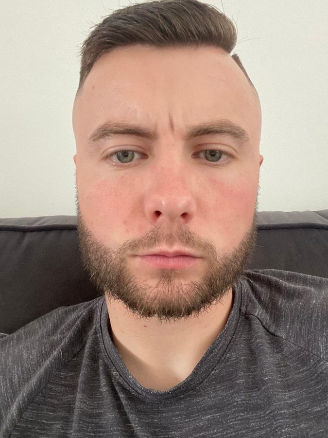 Patient-submitted photograph of a grown-in beard transplant