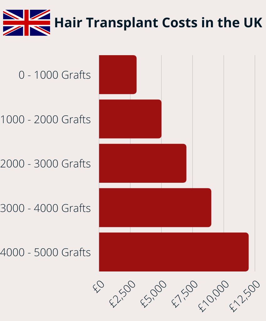 Hair Transplant Costs in the UK