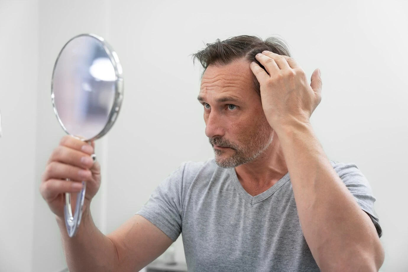 Hormonal Hair Loss